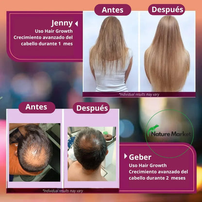 VITAMINAS PARA EL CABELLO - HAIR GROWTH
