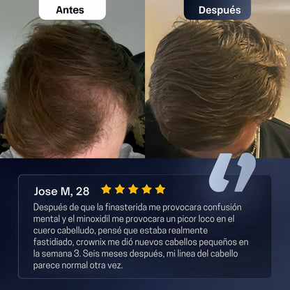 Roll-On de Crecimiento Capilar™ 10ml