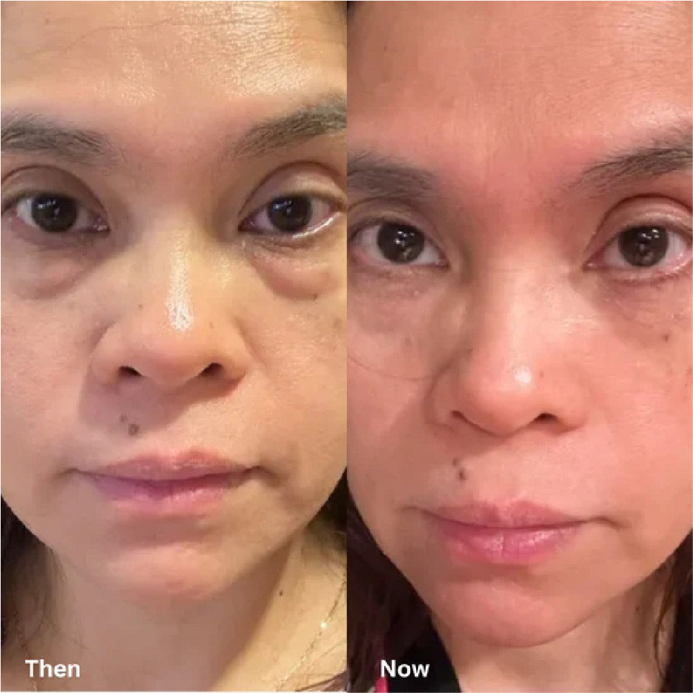 Dr. Melaxin – Bálsamo Contorno de Ojos 10ml