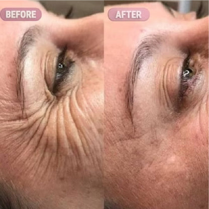 Dr. Melaxin – Bálsamo Contorno de Ojos 10ml